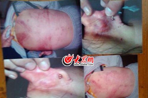 　山東藝術(shù)設(shè)計(jì)學(xué)院16歲女生宿舍內(nèi)被女同學(xué)暴打4小時。