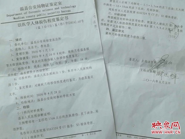 傷情司法鑒定為二級(jí)輕傷