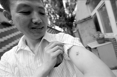 郭學江制服狂徒時被咬傷。京華時報記者潘之望攝