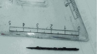 取出的繡花針已發(fā)黑生銹。