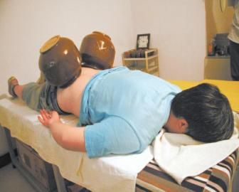 拔泡菜壇子火罐。