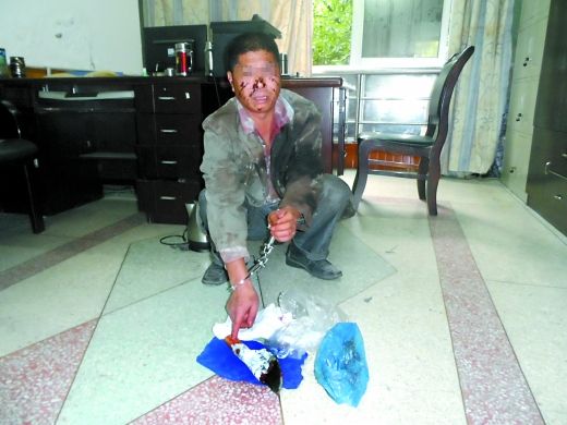   目前張遠已被刑事拘留。