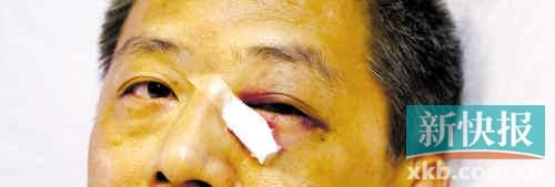 ■這起醫(yī)鬧事件，受傷的遠(yuǎn)遠(yuǎn)不只是熊旭明醫(yī)生的身體。