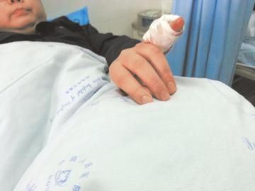 實習(xí)醫(yī)生陳洪左手的小拇指肌腱斷裂。