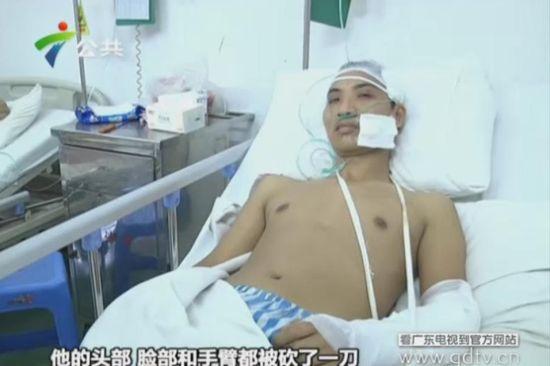 另一名傷者頭部、臉部和手臂都被砍了一刀。(視頻截圖)