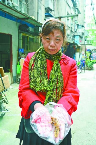 頭部受傷的黃女士展示兩根大魚刺。