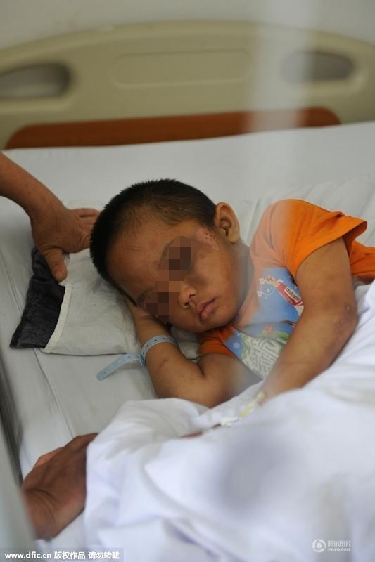 圖為全身傷痕累累的小進(jìn)。