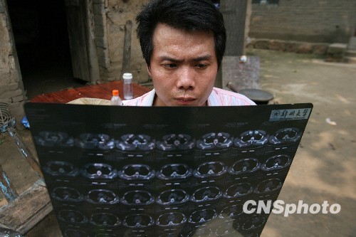 河南"開(kāi)胸驗(yàn)肺者"低保被取消