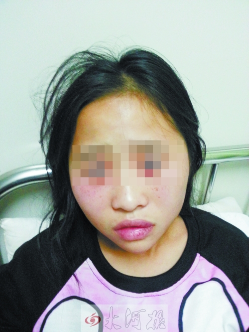 正在醫(yī)院治療的女孩李佳佳