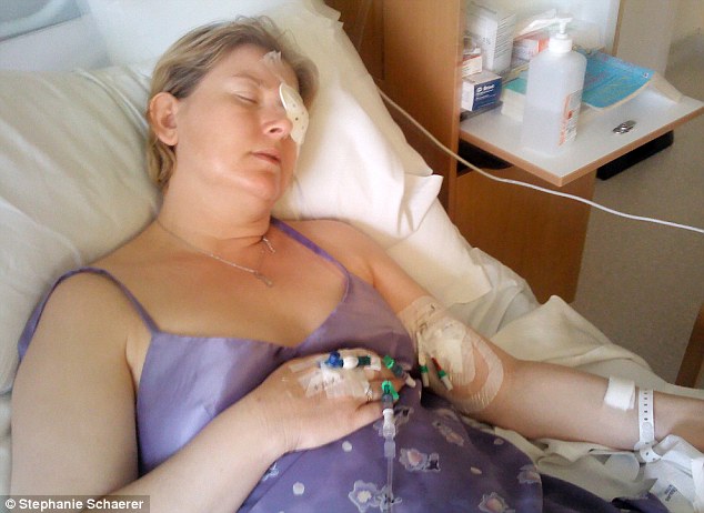 恐怖慎入！隱形眼鏡致英女子摘除眼球