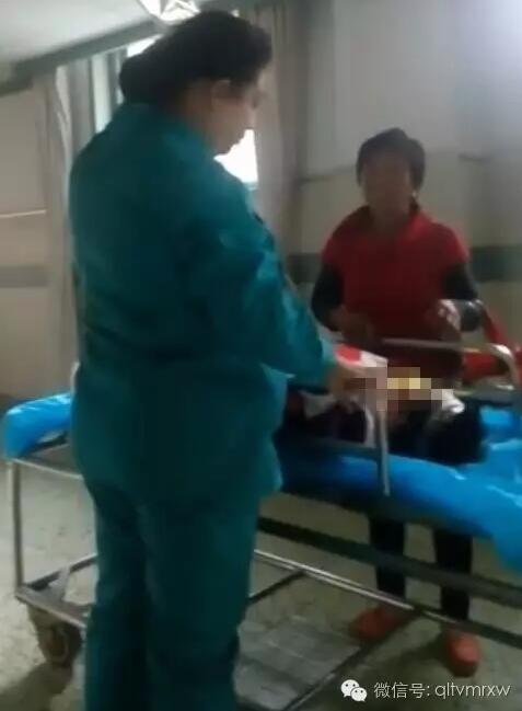 涵涵爸爸告訴《每日新聞》記者：“沒想到是熱水，大人也沒看，一時疏忽，掉進(jìn)去了。抱出來的時候這個皮已經(jīng)掉了。”