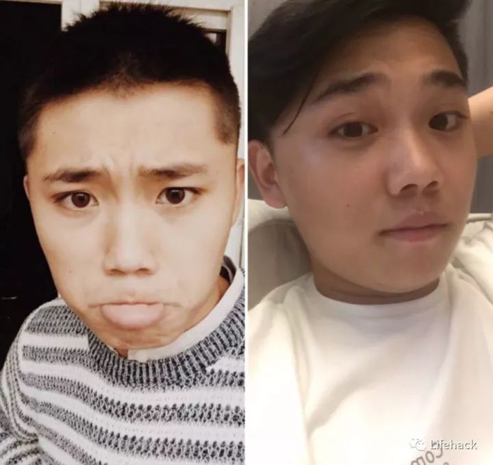 長胖20斤，臉型怎么變？這些例子看完扎心了！