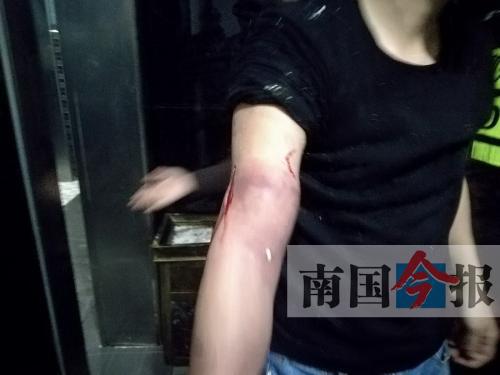 覃先生手臂被卡的部位受傷流血，所幸傷勢無大礙。 通訊員 王建民 攝