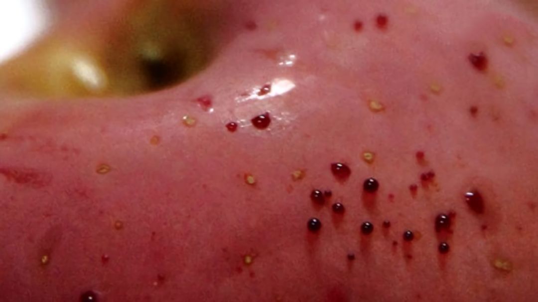 嚇懵！女子用熱水泡蘋果結(jié)果冒出血珠 咋回事？