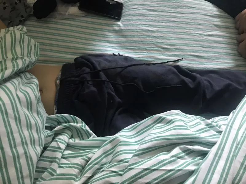 嚇哭！6歲男孩被夾斷手指 罪魁禍?zhǔn)拙故切７? oldsrc=