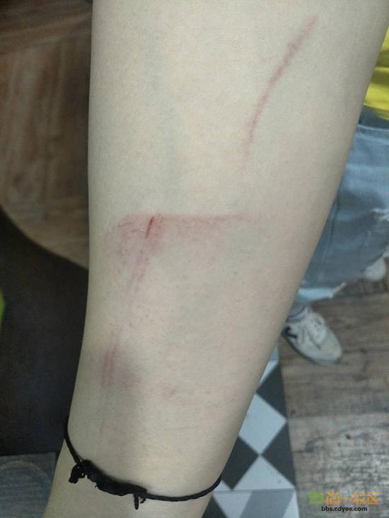 女網(wǎng)友舉報網(wǎng)帖中出示的被打后照片。