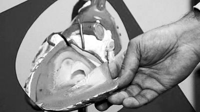 威廉斯領(lǐng)導(dǎo)的研究團(tuán)隊(duì)已經(jīng)利用人體脂肪干細(xì)胞，成功3D打印出心臟血管和心臟瓣膜，待一顆心臟的所有部件打