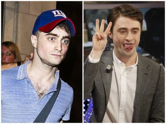 丹尼爾日前被拍到骨瘦如柴，不似2月份健康