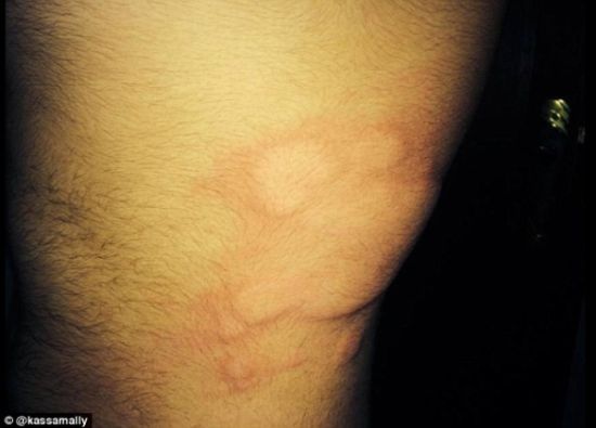 IS被指在敘利亞使用化學(xué)武器 有居民失明起水泡