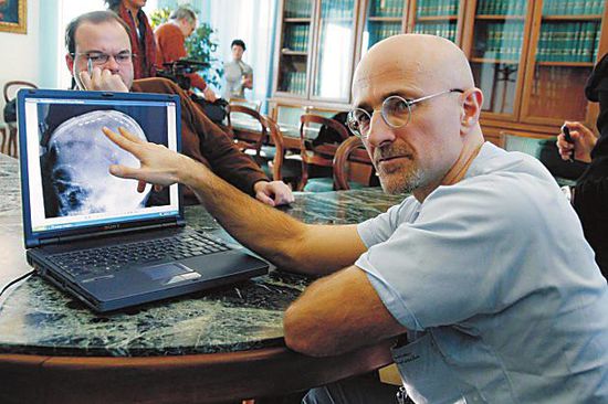 圖為卡納維洛醫(yī)生，不少人認為他的想法非常瘋狂