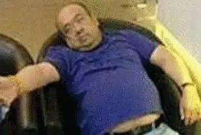 網(wǎng)傳金正男中毒后的照片。