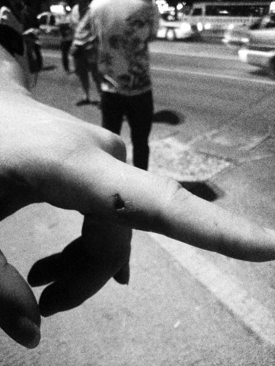 民警食指被咬傷。