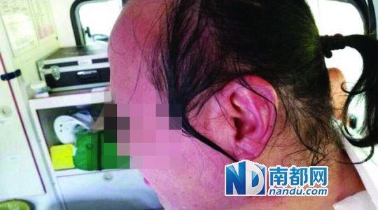 涉事教師遭熱水潑臉后的照片。