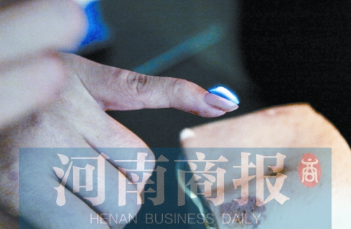 將指甲油涂在指甲上，靠近火焰時(shí)被引燃了