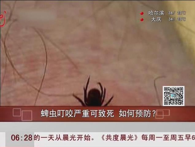 蜱蟲叮咬嚴(yán)重可致死如何預(yù)防？