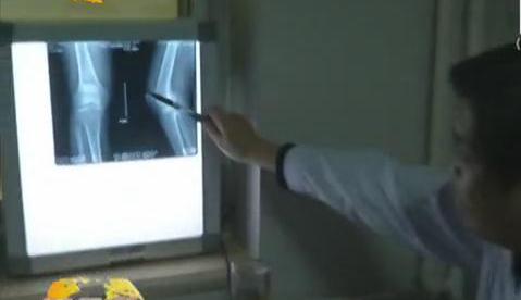 冷空氣來襲 如何預防老寒腿？